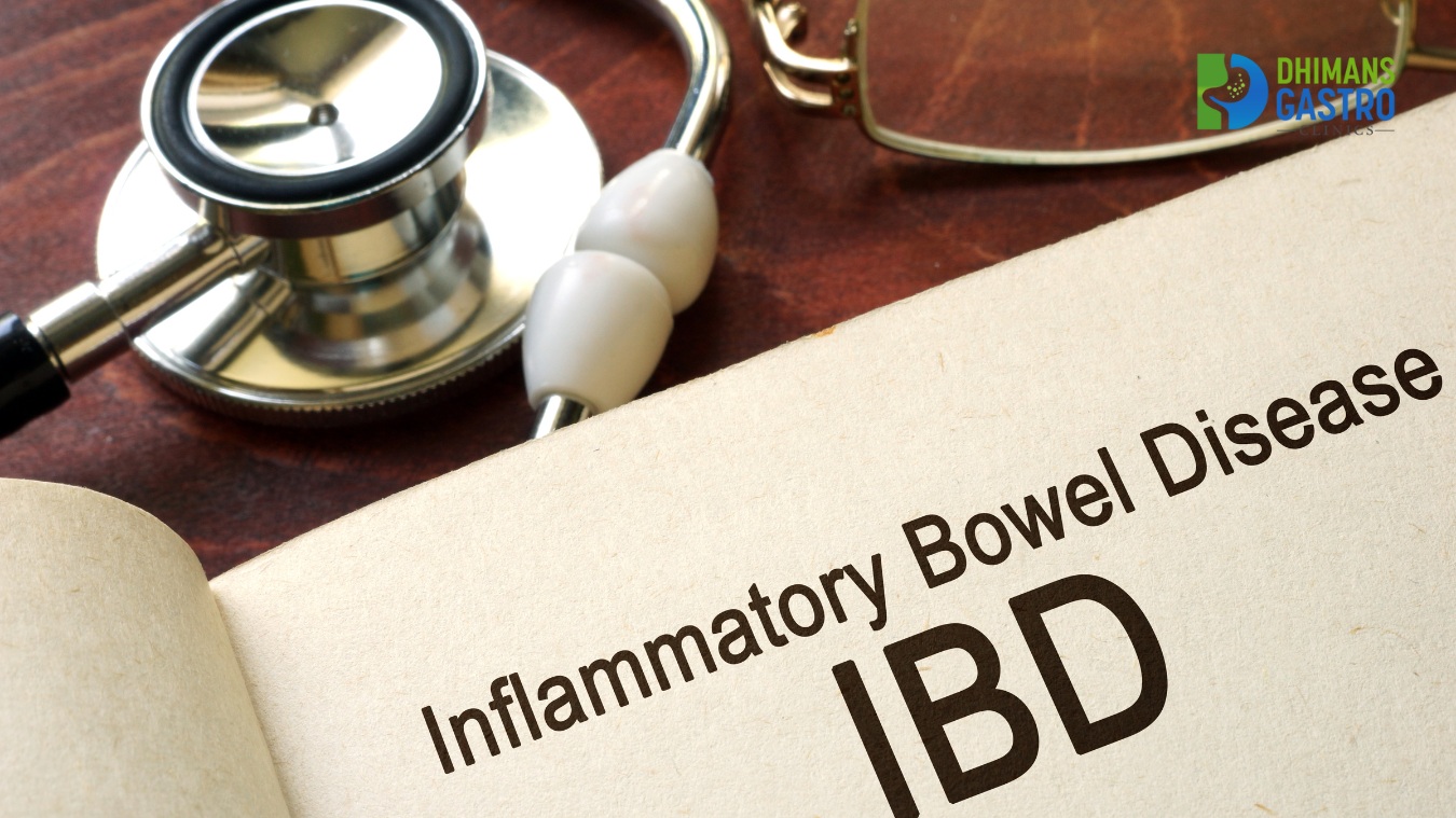 Inflammatory bowel disease (IBD) treatment Khanna