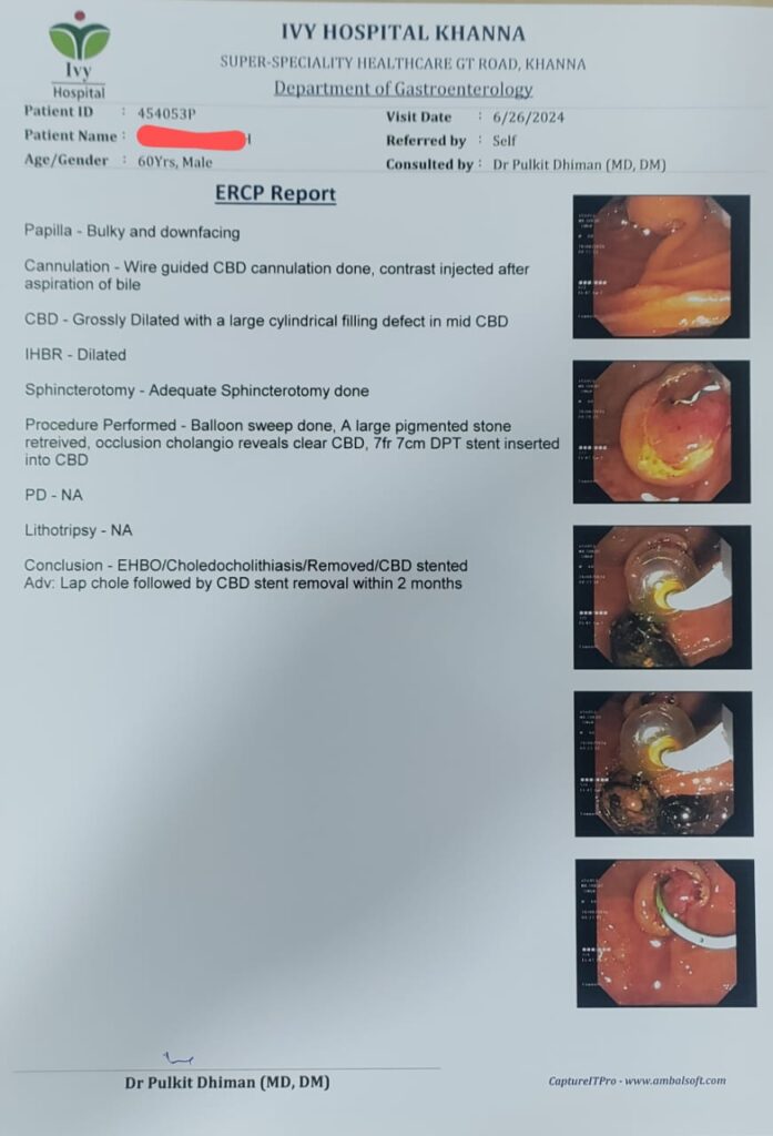 ercp report